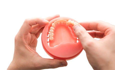Digital Denture