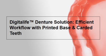 Digitalife™ Denture Solution: Efficient Workflow with Printed Base & Carded Teeth