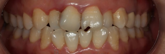 2f72f85b-d58d-d345-e37b-9b033c1138fb_副本.png 2f72f85b-d58d-d345-e37b-9b033c1138fb_副本.png