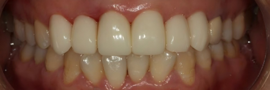 f8341d54-2802-9a9b-ecae-74adee2b725d_副本.png f8341d54-2802-9a9b-ecae-74adee2b725d_副本.png