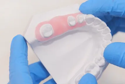 Perfect Fit, Perfect Deal  – GumEasy™ Gingival Mask Special Offer!