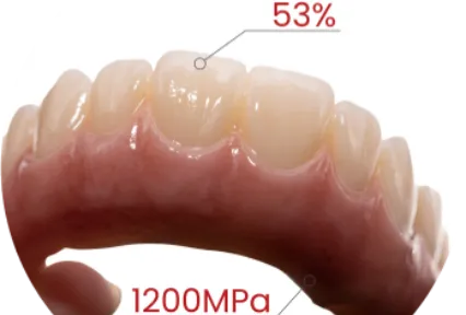 Full-Arch Ready. Esthetics Included.